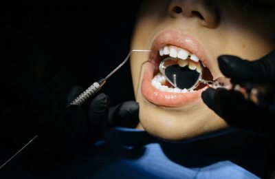 Ile trwa ściąganie zatrzymanego zęba