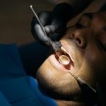Duży ubytek zęba – jak leczyć ubytki próchnicowe?