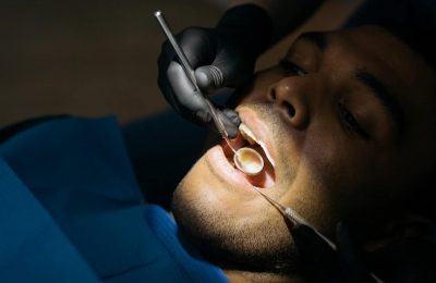 Duży ubytek zęba – jak leczyć ubytki próchnicowe?